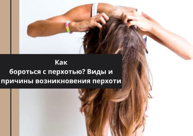 Фото - Как бороться с перхотью? Виды и причины возникновения перхоти